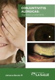 Conjuntivitis alérgicas (eBook, ePUB)