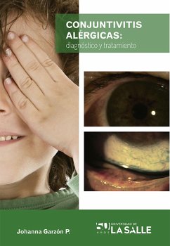 Conjuntivitis alérgicas (eBook, ePUB) - Garzón Parra, Sandra Johanna