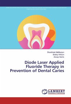 Diode Laser Applied Fluoride Therapy in Prevention of Dental Caries
