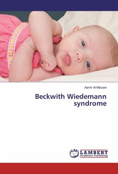 Beckwith Wiedemann syndrome - Al Mosawi, Aamir