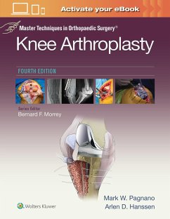 Master Techniques in Orthopedic Surgery: Knee Arthroplasty (Master Techniques in Orthopaedic Surgery) - Pagnano, Mark W.