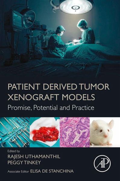 Patient Derived Tumor Xenograft Models (eBook, ePUB) Patient Derived Tumor Xenograft Models (eBook, ePUB)