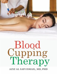 Blood Cupping Therapy - Ismail, Md