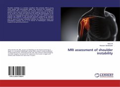 MRI assessment of shoulder instability