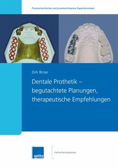 Dentale Prothetik - begutachtete Planungen, therapeutische Empfehlungen (eBook, PDF) - Brose, Dirk