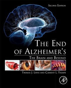 The End of Alzheimer's - Lewis, Thomas J.;Trempe, Clement L.