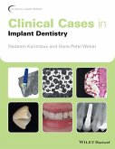 Clinical Cases in Implant Dentistry (eBook, ePUB)