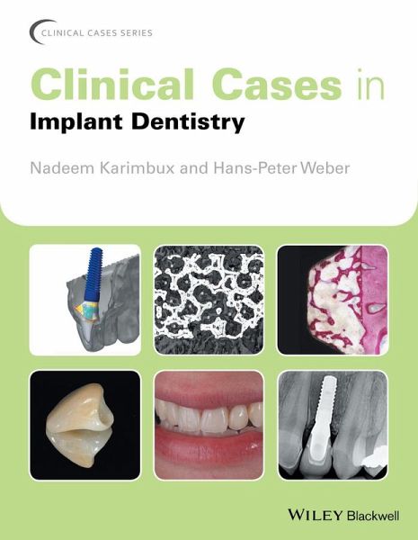 Clinical Cases in Implant Dentistry (eBook, ePUB) Clinical Cases in Implant Dentistry (eBook, ePUB)