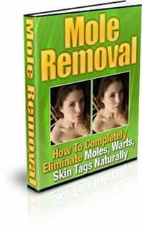 Mole Removal (eBook, PDF) - Collectif, Ouvrage