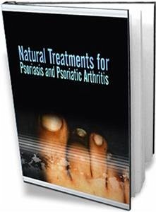 Natural treatments for psoriasis and psoriatic arthritis (eBook, PDF) - Collectif, Ouvrage