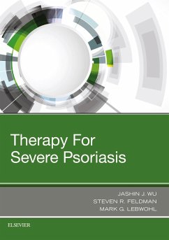 Therapy for Severe Psoriasis E-Book (eBook, ePUB) - Wu, Jashin J.; Feldman, Steven R.; Lebwohl, Mark G.