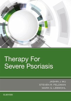 Therapy for Severe Psoriasis E-Book (eBook, ePUB) - Wu MD, Jashin J.; Feldman MD; Lebwohl MD, Faad