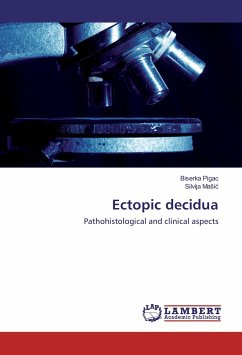 Ectopic decidua