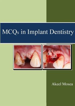 MCQs in Implant Dentistry - Mosea, Akeel