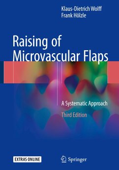 Raising of Microvascular Flaps - Hölzle, Frank;Wolff, Klaus-Dietrich