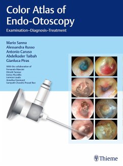 Color Atlas of Endo-Otoscopy - Sanna, Mario; Russo, Alessandra; Caruso, Antonio; Taibah, Abdelkader; Piras, Gianluca