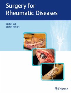Surgery for Rheumatic Diseases - Sell, Stefan; Rehart, Stefan