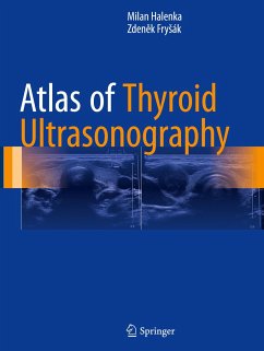 Atlas of Thyroid Ultrasonography - Halenka, Milan;Frysák, Zdenek