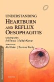 Understanding Heartburn and Reflux Oesophagitis - e-Book (eBook, ePUB)