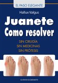 Juanete - Resolver sin cirugía (eBook, ePUB)