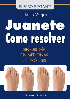 Juanete - Resolver sin cirugía (fixed-layout eBook, ePUB) - Guglielmotti, Gustavo