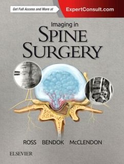 Imaging in Spine Surgery - Ross, Jeffrey S.;Bendock, Bernard R.;McClendon Jr., Jamal