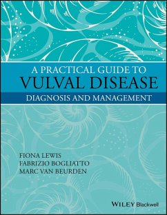 A Practical Guide to Vulval Disease (eBook, ePUB) - Lewis, Fiona M.; Bogliatto, Fabrizio; Beurden, Marc van