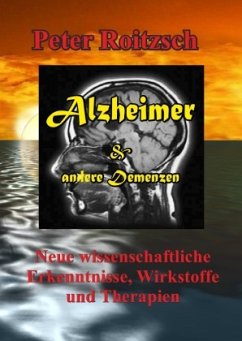 Alzheimer & andere Demenzen - Roitzsch, Peter