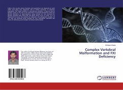 Complex Vertebral Malformation and FXI Deficiency - Khade, Shrikant