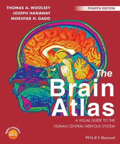 The Brain Atlas (eBook, PDF) - Woolsey, Thomas A.; Hanaway, Joseph; Gado, Mokhtar H.