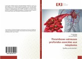 Thromboses veineuses profondes associées aux néoplasies