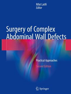 Surgery of Complex Abdominal Wall Defects