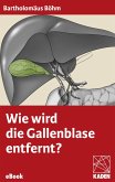 Wie wird die Gallenblase entfernt? (eBook, ePUB)