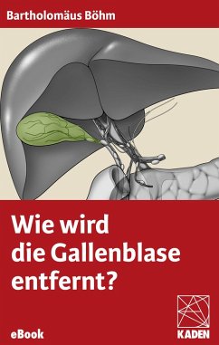 Cover Wie wird die Gallenblase entfernt? (eBook, ePUB)