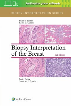 Biopsy Interpretation of the Breast - Schnitt, Stuart J.; Collins, Laura C.