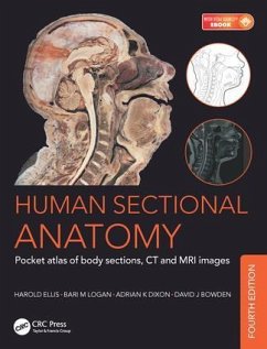 Human Sectional Anatomy - Dixon, Adrian Kendal (Emeritus Professor, Department of Radiology, U; Bowden, David J. (Abdominal Imaging Fellow, Department of Medical Im; Logan, Bari M. (Formerly University Prosector, Department of Anatomy