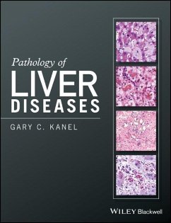 Pathology of Liver Diseases - Kanel, Gary C.