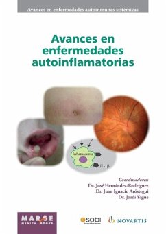 Avances en enfermedades autoinflamatorias - Cervera, Ricard; Hernández-Rodríguez, José; Aróstegui, Juan Ignacio