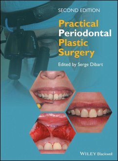 Cover Practical Periodontal Plastic Surgery (eBook, PDF)