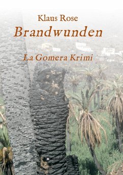 Brandwunden