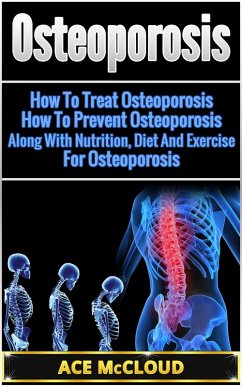 Osteoporosis: How To Treat Osteoporosis: How To Prevent Osteoporosis: Along With Nutrition, Diet And Exercise For Osteoporosis (eBook, ePUB) - Mccloud, Ace