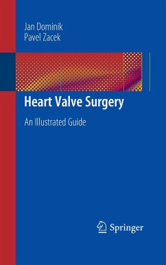 Heart Valve Surgery - Dominik, Jan;Zacek, Pavel