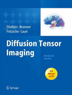 Diffusion Tensor Imaging - Stieltjes, Bram;Brunner, Romuald M.;Fritzsche, Klaus