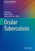 Ocular Tuberculosis