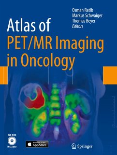 Atlas of PET/MR Imaging in Oncology