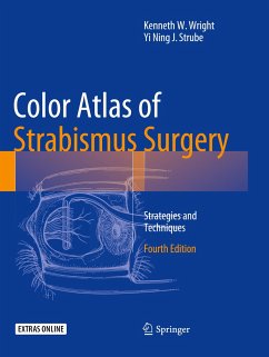 Color Atlas Of Strabismus Surgery - Wright, Kenneth W.;Strube, Yi Ning J.