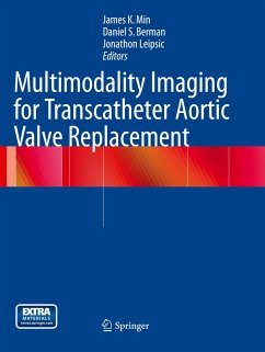 Multimodality Imaging for Transcatheter Aortic Valve Replacement