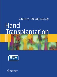 Hand transplantation