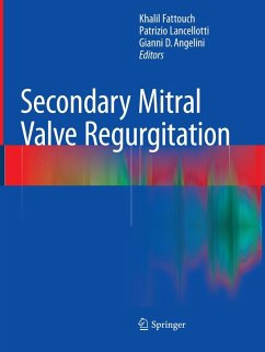 Cover Secondary Mitral Valve Regurgitation