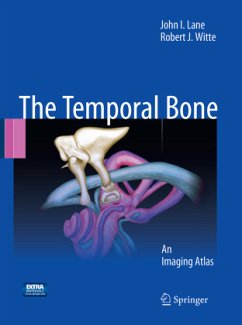 Temporal Bone - Lane, John I.;Witte, Robert J.